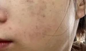 Nhanh già sau 'dao kéo' nâng cấp nhan sắc Nhanh già sau 'dao kéo' nâng cấp nhan sắc